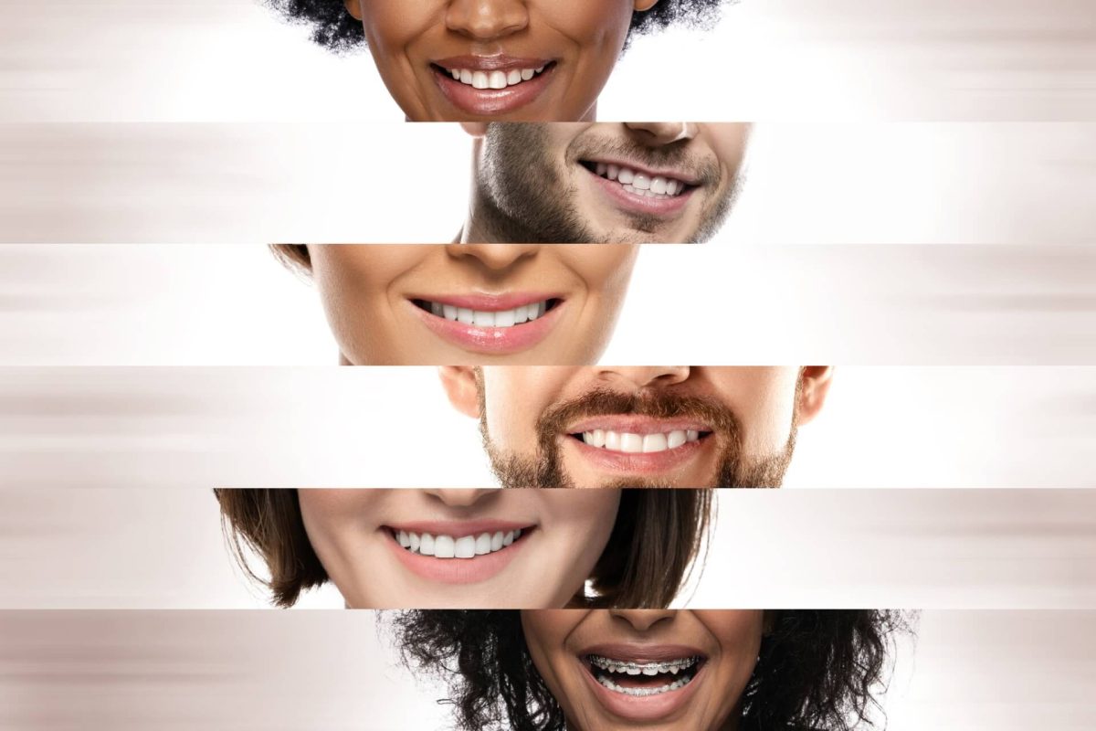 Cosmetic dentistry vs general dentistry